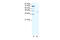 TAL BHLH Transcription Factor 1, Erythroid Differentiation Factor antibody, 31-158, ProSci, Western Blot image 