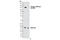 ALK Receptor Tyrosine Kinase antibody, 4144S, Cell Signaling Technology, Western Blot image 