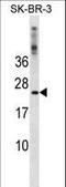 Frataxin antibody, LS-C157755, Lifespan Biosciences, Western Blot image 