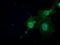 Probable N-acetyltransferase 8 antibody, GTX84063, GeneTex, Immunocytochemistry image 