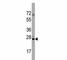 CD9 Molecule antibody, F44201-0.4ML, NSJ Bioreagents, Western Blot image 