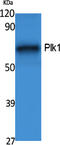 Polo Like Kinase 1 antibody, STJ96419, St John