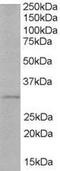 TIR Domain Containing Adaptor Protein antibody, PA5-17970, Invitrogen Antibodies, Western Blot image 