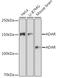 Adenosine Deaminase RNA Specific antibody, GTX64415, GeneTex, Western Blot image 