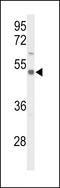 Solute Carrier Family 39 Member 8 antibody, LS-C162841, Lifespan Biosciences, Western Blot image 