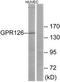 Adhesion G Protein-Coupled Receptor G6 antibody, TA315653, Origene, Western Blot image 