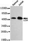 LCK Proto-Oncogene, Src Family Tyrosine Kinase antibody, MBS475086, MyBioSource, Western Blot image 