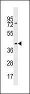 Kynurenine Aminotransferase 3 antibody, 60-279, ProSci, Western Blot image 