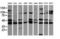 Mitogen-Activated Protein Kinase Kinase 1 antibody, LS-C174513, Lifespan Biosciences, Western Blot image 