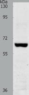 E3 ubiquitin-protein ligase TRAF7 antibody, TA321914, Origene, Western Blot image 