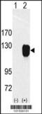 Receptor Tyrosine Kinase Like Orphan Receptor 1 antibody, 63-128, ProSci, Western Blot image 