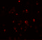 Teratocarcinoma-Derived Growth Factor 1 antibody, 7099, ProSci Inc, Immunofluorescence image 