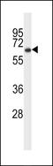 Cortactin antibody, LS-C161490, Lifespan Biosciences, Western Blot image 