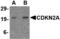 p16-INK4 antibody, MBS150506, MyBioSource, Western Blot image 