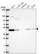 N-Terminal EF-Hand Calcium Binding Protein 3 antibody, NBP2-68925, Novus Biologicals, Western Blot image 