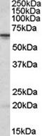 Serine/Threonine Kinase 17b antibody, orb20258, Biorbyt, Western Blot image 