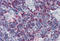 Lymphocyte Cytosolic Protein 2 antibody, SP3000P, Origene, Immunohistochemistry frozen image 