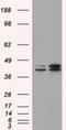 Nucleoredoxin Like 2 antibody, NBP2-02605, Novus Biologicals, Western Blot image 