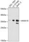 Annexin A10 antibody, 19-394, ProSci, Western Blot image 