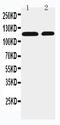 Solute Carrier Family 12 Member 3 antibody, PA2170, Boster Biological Technology, Western Blot image 