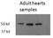 Thyroid Hormone Receptor Beta antibody, AP33293PU-N, Origene, Western Blot image 