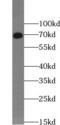 Lymphocyte Cytosolic Protein 2 antibody, FNab07988, FineTest, Western Blot image 