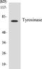 Tyrosinase antibody, EKC1583, Boster Biological Technology, Western Blot image 