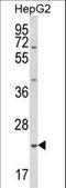 Glutathione S-transferase 5.7 antibody, LS-C166706, Lifespan Biosciences, Western Blot image 