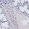 Perforin 1 antibody, 13-029, ProSci, Immunohistochemistry paraffin image 