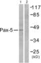 Paired Box 5 antibody, abx013173, Abbexa, Western Blot image 