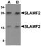 CD48 Molecule antibody, NBP1-76556, Novus Biologicals, Western Blot image 