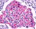 Catenin Beta 1 antibody, V2103IHC-7ML, NSJ Bioreagents, Immunohistochemistry paraffin image 