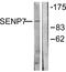 SUMO Specific Peptidase 7 antibody, A08121-1, Boster Biological Technology, Western Blot image 