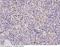 Folate Receptor Beta antibody, 11219-R001, Sino Biological, Immunohistochemistry paraffin image 