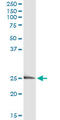 Endothelin 3 antibody, LS-B12661, Lifespan Biosciences, Immunoprecipitation image 