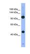 Proteasome 26S Subunit, Non-ATPase 1 antibody, NBP1-58214, Novus Biologicals, Western Blot image 