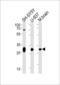 Acidic Nuclear Phosphoprotein 32 Family Member E antibody, LS-C344600, Lifespan Biosciences, Western Blot image 