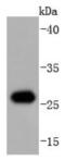 Heat Shock Protein Family B (Small) Member 1 antibody, NBP2-67896, Novus Biologicals, Western Blot image 