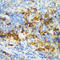 CD3d Molecule antibody, 14-385, ProSci, Immunohistochemistry paraffin image 