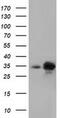 Peroxisomal Trans-2-Enoyl-CoA Reductase antibody, MA5-25262, Invitrogen Antibodies, Western Blot image 