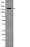 DNA Topoisomerase II Binding Protein 1 antibody, PA5-64857, Invitrogen Antibodies, Western Blot image 