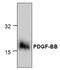 Platelet Derived Growth Factor Subunit B antibody, GTX59863, GeneTex, Western Blot image 