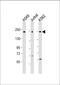 Proteasome Activator Subunit 4 antibody, MBS9216955, MyBioSource, Western Blot image 