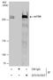 Mechanistic Target Of Rapamycin Kinase antibody, GTX101557, GeneTex, Immunoprecipitation image 