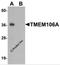 Transmembrane protein 106A antibody, 6781, ProSci, Western Blot image 