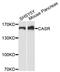 F-Box And WD Repeat Domain Containing 7 antibody, abx001232, Abbexa, Western Blot image 