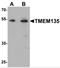 Transmembrane Protein 135 antibody, NBP2-81869, Novus Biologicals, Western Blot image 