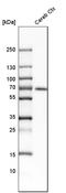 Calcium/Calmodulin Dependent Protein Kinase Kinase 2 antibody, HPA017389, Atlas Antibodies, Western Blot image 