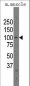 Poly(ADP-Ribose) Polymerase Family Member 12 antibody, LS-C100028, Lifespan Biosciences, Western Blot image 