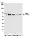 Peptidylprolyl Isomerase Like 4 antibody, A304-965A, Bethyl Labs, Western Blot image 